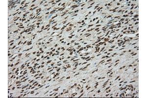 Immunohistochemical staining of paraffin-embedded colon tissue using anti-TYRO3mouse monoclonal antibody. (TYRO3 anticorps)
