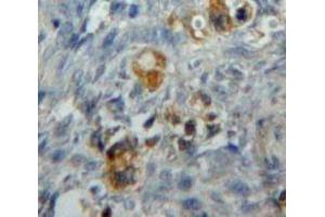 IHC-P analysis of Ovary tissue, with DAB staining. (CD276 anticorps  (AA 47-213))