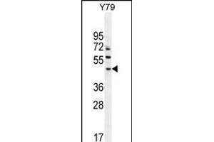 LACE1 Antibody (N-term) (ABIN654572 and ABIN2844276) western blot analysis in Y79 cell line lysates (35 μg/lane). (LACE1 anticorps  (N-Term))
