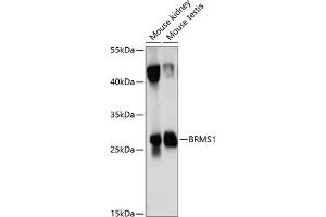 Western blot analysis of extracts of various cell lines, using BRMS1 antibody (ABIN7265929) at 1:1000 dilution. (BRMS1 anticorps  (AA 90-210))