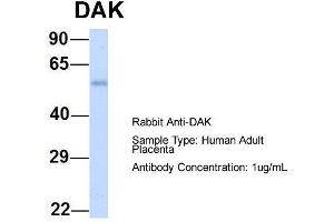 Host: Rabbit  Target Name: DAK  Sample Tissue: Human Adult Placenta  Antibody Dilution: 1. (DAK anticorps  (N-Term))