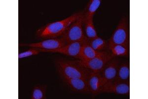 IF analysis of RAP1GDS1 using anti-RAP1GDS1 antibody (ABIN7601725). (RAP1GDS1 anticorps  (AA 43-607))