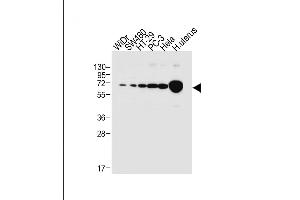 All lanes : Anti-NOX1 Antibody (Center) at 1:1000 dilution Lane 1: WiDr whole cell lysate Lane 2: S whole cell lysate Lane 3: HT-29 whole cell lysate Lane 4: PC-3 whole cell lysate Lane 5: Hela whole cell lysate Lane 6: human uterus tissue lysate Lysates/proteins at 20 μg per lane. (NOX1 anticorps  (AA 243-271))