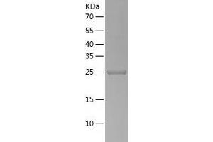 Western Blotting (WB) image for Ubiquitin Specific Peptidase 33 (USP33) (AA 71-303) protein (His-IF2DI Tag) (ABIN7125594)