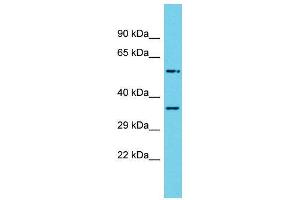 Host:  Rabbit  Target Name:  Rnf14  Sample Type:  Rat Small Intestine lysates  Antibody Dilution:  1.