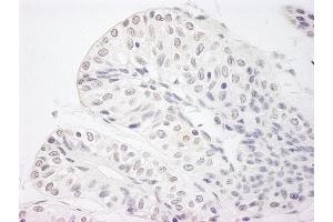 Immunohistochemistry (IHC) image for anti-Lysine (K)-Specific Demethylase 5A (KDM5A) (AA 1640-1690) antibody (ABIN7448612) (KDM5A anticorps  (AA 1640-1690))
