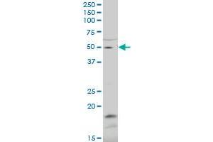 ZNF83 polyclonal antibody (A01), Lot # 051115JC01. (ZNF83 anticorps  (AA 1-111))