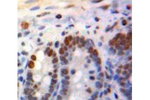 IHC-P analysis of Bowels tissue, with DAB staining. (KLF4 anticorps  (AA 240-478))