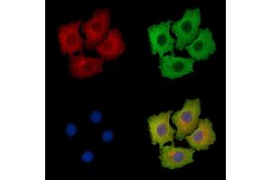 ABIN7095914 and ABIN7099976 staining HepG2 cells by IF/ICC. (CCSER1 anticorps)
