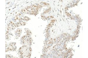 Immunohistochemistry (IHC) image for anti-Ubiquitin Specific Peptidase 7 (Herpes Virus-Associated) (USP7) (AA 1-50) antibody (ABIN7453547) (USP7 anticorps  (AA 1-50))