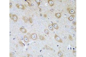 Immunohistochemistry of paraffin-embedded Mouse brain using TMOD3 Polyclonal Antibody at dilution of 1:100 (40x lens). (TMOD3 anticorps)