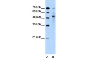 Western Blotting (WB) image for anti-Tripartite Motif Containing 59 (TRIM59) antibody (ABIN2462701) (TRIM59 anticorps)