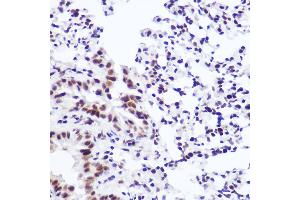 Immunohistochemistry of paraffin-embedded mouse lung using USP39 Rabbit mAb (ABIN7271160) at dilution of 1:100 (40x lens). (USP39 anticorps)