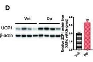 Diphyllin enhances brown/beige thermogenesis and reduces adipocyte size in DIO mice.