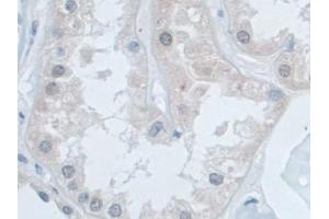 Detection of SNRPD1 in Human Kidney Tissue using Polyclonal Antibody to Small Nuclear Ribonucleoprotein Polypeptide D1 (SNRPD1) (SNRPD1 anticorps  (AA 1-119))