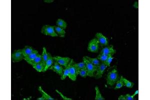 Immunofluorescent analysis of HepG2 cells using ABIN7168819 at dilution of 1:100 and Alexa Fluor 488-congugated AffiniPure Goat Anti-Rabbit IgG(H+L)