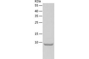 Western Blotting (WB) image for Synaptonemal Complex Central Element Protein 3 (SYCE3) (AA 1-88) protein (His tag) (ABIN7125268)