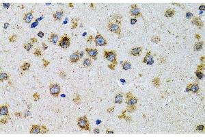Immunohistochemistry of paraffin-embedded Rat brain using PDYN Polyclonal Antibody at dilution of 1:100 (40x lens). (PDYN anticorps)