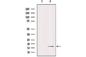 Western blot analysis of extracts from MCF7, using MtSSB Antibody.