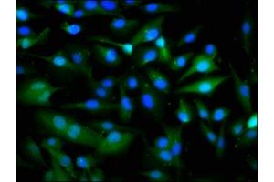 Immunofluorescence staining of U251 cells with ABIN7162583 at 1:266, counter-stained with DAPI.