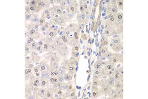 Immunohistochemistry of paraffin-embedded rat liver using DTX2 antibody (ABIN6127799, ABIN6139853, ABIN6139854 and ABIN6223266) at dilution of 1:100 (40x lens). (DTX2 anticorps  (AA 1-280))