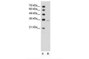 Image no. 1 for anti-phosphoribosyl Pyrophosphate Synthetase 2 (PRPS2) (AA 157-206) antibody (ABIN203392) (PRPS2 anticorps  (AA 157-206))