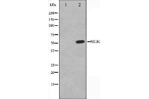 Western blot analysis of SGK expression in Jurkat whole cell lysates,The lane on the left is treated with the antigen-specific peptide. (SGK1 anticorps  (C-Term))