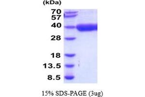 SDS-PAGE (SDS) image for Cathepsin Z (CTSZ) (AA 23-306) protein (His tag) (ABIN5854507) (Cathepsin Z Protein (CTSZ) (AA 23-306) (His tag))
