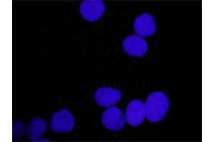 Representative image of Proximity Ligation Assay of protein-protein interactions between PDGFA and PLCG1. (PDGFA & PLCG1 Protein Protein Interaction Antibody Pair)