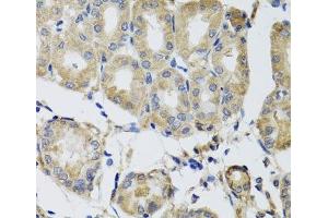 Immunohistochemistry of paraffin-embedded Human stomach using MRPS22 Polyclonal Antibody at dilution of 1:100 (40x lens). (MRPS22 anticorps)