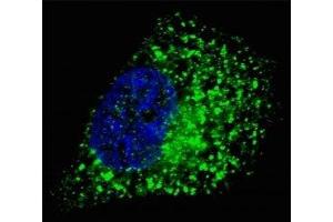 Fluorescent image of Chloroquine treated U251 cells stained with GABARAP antibody. (GABARAP anticorps  (AA 1-30))