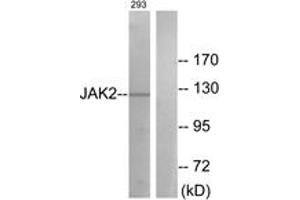 Western blot analysis of extracts from 293 cells, treated with etoposide 25uM 24h, using JAK2 (Ab-570) Antibody. (JAK2 anticorps  (AA 541-590))
