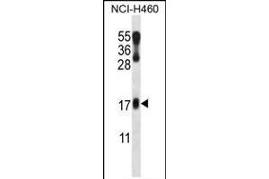 LMO2 Antibody (N-term) (ABIN658023 and ABIN2846961) western blot analysis in NCI- cell line lysates (35 μg/lane). (LMO2 anticorps  (N-Term))