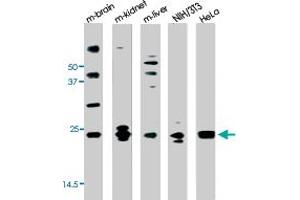 Western blot analysis of PARK7 polyclonal antibody  in mouse brain,kidney,liver tissue lysates and NIH-3T3, HeLa cell line lysates (35 ug/lane).