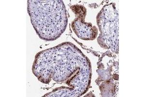 Immunohistochemical staining of human placenta with CC2D2A polyclonal antibody  shows strong nuclear and cytoplasmic positivity in trophoblastic cells. (CC2D2A anticorps)