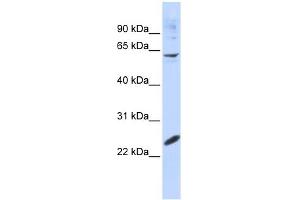 WB Suggested Anti-SMAD4 Antibody Titration:  0. (SMAD4 anticorps  (N-Term))