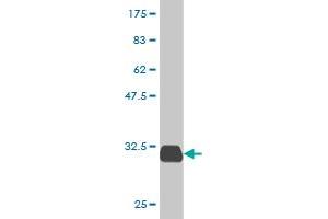 Western Blot detection against Immunogen (31.