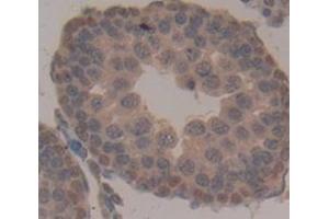 Used in DAB staining on fromalin fixed paraffin- embedded Kidney tissue (TPSB2 anticorps  (AA 30-274))