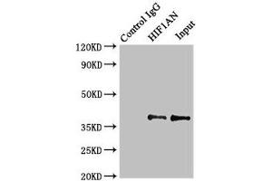 Immunoprecipitating HIF1AN in MCF-7 whole cell lysate Lane 1: Rabbit control IgG instead of (1 μg) instead of ABIN7156025 in MCF-7 whole cell lysate.