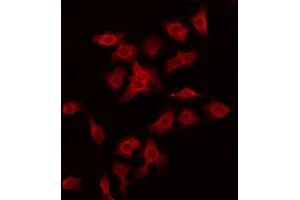 ABIN6275981 staining Hela by IF/ICC. (CSRL1 anticorps)