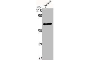 Western Blot analysis of Jurkat cells using Kv3. (Kv3.4 anticorps)
