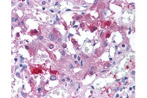 Anti-USP20 antibody IHC of human adrenal medulla.