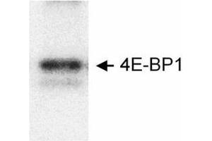 Western Blotting (WB) image for anti-Mechanistic Target of Rapamycin (serine/threonine Kinase) (mTOR) (Exon 5), (Exon 6) antibody (ABIN2487252)