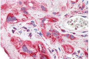 anti-Complement Component 5a Receptor 1 (C5AR1) antibody