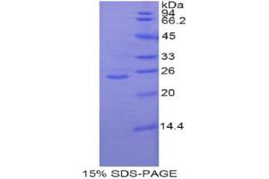 SDS-PAGE analysis of Rat GCLC Protein. (GCLC Protéine)