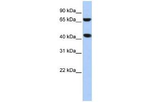 ELAC1 antibody used at 1 ug/ml to detect target protein. (ELAC1 anticorps)