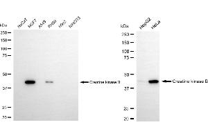 Western blotting analysis using creatine kinase B antibody (ABIN7798161). (Recombinant CKB anticorps)
