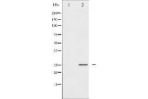 Western blot analysis of eIF4E expression in FBS treated NIH-3T3 whole cell lysates,The lane on the left is treated with the antigen-specific peptide. (EIF4E anticorps  (C-Term))