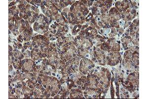 Image no. 12 for anti-Prefoldin Subunit 3 (PFDN3) antibody (ABIN1501704)