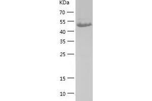 Western Blotting (WB) image for Pyruvate Dehydrogenase Complex, Component X (PDHX) (AA 54-501) protein (His-IF2DI Tag) (ABIN7124721)